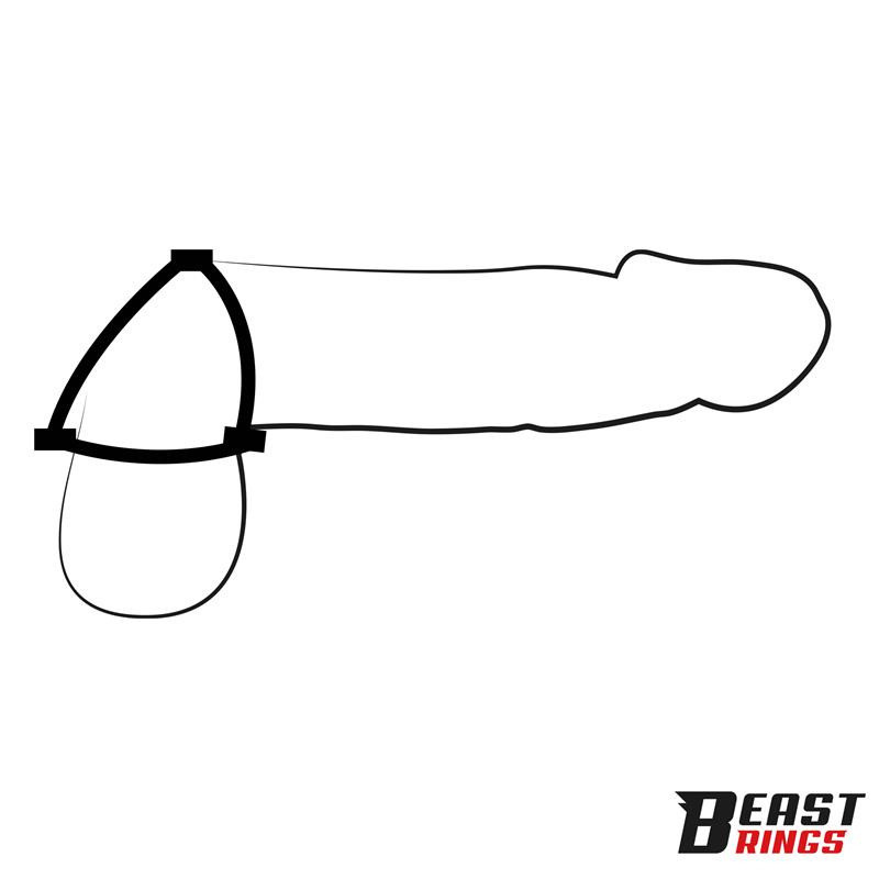 Anneau Triple