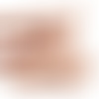 Torse Apollon L Flesh Gode 17,7 cm