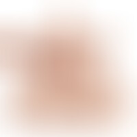 Torse Apollon L Flesh Gode 17,7 cm