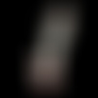 Gode Model 1 Rose Phosphorescent