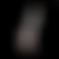 Gode Model 1 Rose Phosphorescent