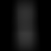Clear Gode Transparent 21 cm x 4 cm